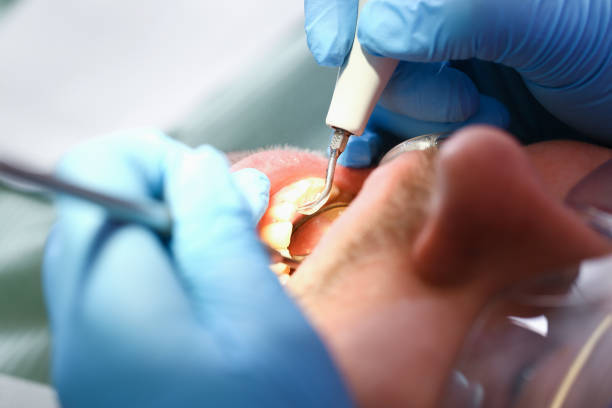 Best Emergency Gum Pain Relief  in Weddington, NC
