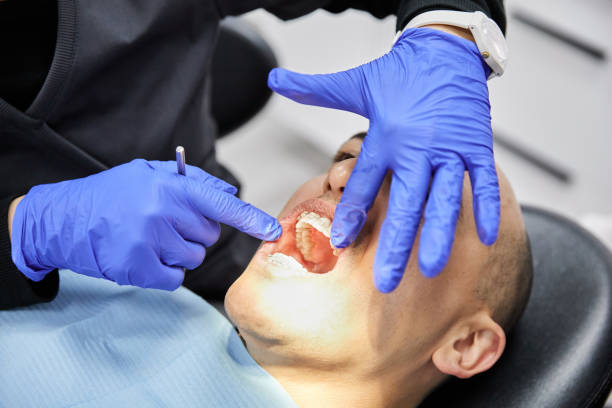 Best Chipped Tooth Repair Near Me  in Weddington, NC